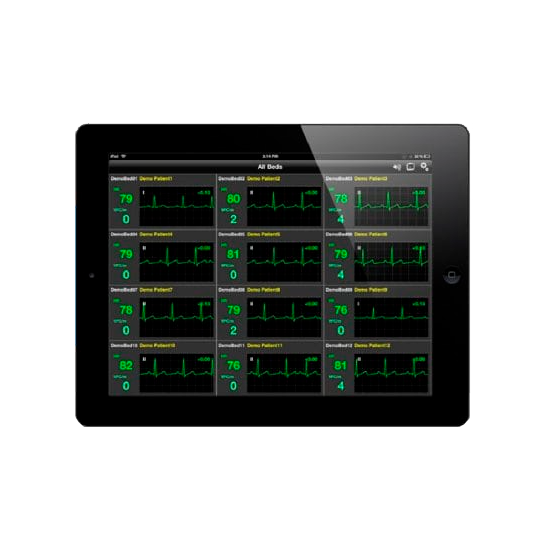 玻璃感測觸控 (Glass Sensor) - 具備高穿透率與極窄邊框設計的顯示方案